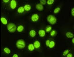 Image result for ANA Staining Pattern