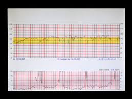 archiving fetal monitoring strips from legacy perinatal ehrs