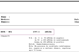 Beta Hcg Quantitativo Como Entender O Resultado Teste De Gravidez Positivo Exame De Gravidez Teste De Gravidez