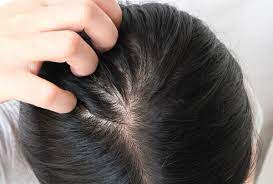 We recommend spending at least $15 if you want a quality product. Itchy Scalp Causes Treatment When To See A Doctor