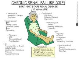 Esrd End Stage Renal Disease Dialysis Nurse Nurse Nursing School