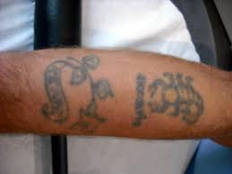 The laser light passes through the skin and targets the ink in the tattoo. Tattoo Removal Vale Laser Clinic