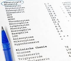 Das kleine blutbild wird im rahmen vieler routineuntersuchungen durchgeführt. Ein Blutbild Machen Lassen Das Mussen Sie Beachten