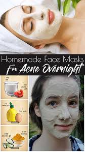 homemade face l mask for acne