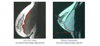 여성의류 스토어팜 리플링(liebling) 바로가기 입니다. Mediment