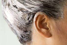 You can let it sit for a while and then rub it off gently to remove the stain. 10 Tips On How To Remove Hair Dye Or Colour Stains From Skin