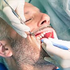 Nov 10, 2020 · although much of the bacteria on your food or in your drinks is swallowed and dissolved by stomach acid, some of it stays behind and sticks to your teeth. You Need A Dentist To Remove Tartar From Your Teeth
