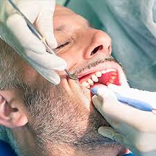 Once tartar forms, it starts to destroy gum tissue, causing gums to bleed and pull away from the teeth. You Need A Dentist To Remove Tartar From Your Teeth Sitnik Dental