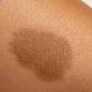 Skin & Stuff - Dermatology with James Britton event image