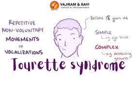 Image result for Tic Disorder