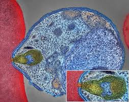 Update information for malarie howard ». Malaria Wikipedia