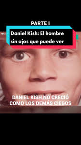 Daniel Kish