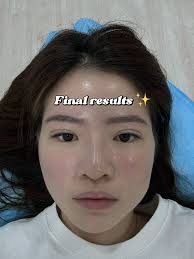 DOUBLE EYELIDS IN 30MINS⁉️