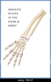 Image result for Hand Growth Plates