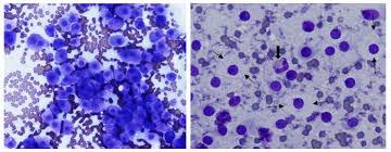 The median survival rate after splenectomy is 14 months (versus four to six. Color Cytology Atlas Of Common Feline Skin Tumors Mspca Angell