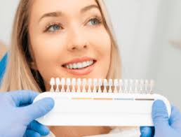 Discover the Advantages of Teeth Whitening Services