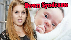 Princess Beatrice's daughter Sienna hospitalized when she was diagnosed  with Down syndrome