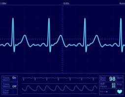Image result for Electrocardiogram