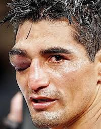 Erik Morales one of my fav Mexican boxers all time!!