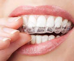 Trouver le meilleur dentiste dans votre ville et prendre soin de vos dents. Prix Tarif Consultation Dentiste Remboursement Des Soins Dentaires