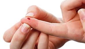 Possiamo quindi considerare un'intolleranza alimentare come un malessere. Laboratorio Di Analisi Analisi Cliniche Centro Analisi