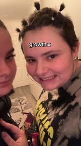 Osteosarcoma in Shoulder