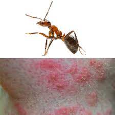 comment distinguer les differentes piqures d insectes piqure insecte piqure piqure de tique
