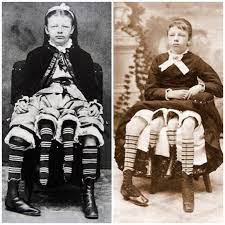 Myrtle corbin as a young girl. The Story Of Myrtle Corbin