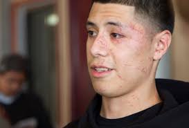 What it Was Like in West, Texas the Day After the Explosion