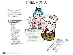 Pneumonia Diagram Quizlet