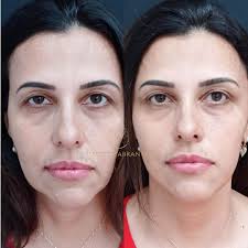 Daniela Abrantes (@dradani.abrantes) • Instagram photos and videos