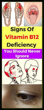 Vitamin b12 deficiency, also known as cobalamin deficiency, is the medical condition of low blood and tissue levels of vitamin b12. Pin On Nails Skin Care Make Up