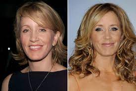 23.01.2013 · did she have plastic surgery to keep her look youthful? Stars Who Look Better With Age Celebrity Plastic Surgery Hair Implants Anti Aging Hair