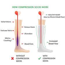 Compression Knee High Look So Good Plus Comfortable