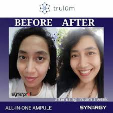 Trulum skin care (jujur tanpa rekayasa). Trulum 5 Ml Original Menghilangkan Flek Hitam Bopeng Dan Bekas Jerawat Shopee Indonesia