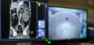 Each has its own strengths. Diagnosing Cancer With An Abdomen Ct Scan American Health Imaging