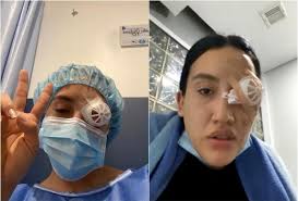 Paro nacional hoy: Universitaria en Bogotá pierde el ojo tras protestas