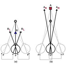 Double vision where the two images are separated laterally (horizontally). Figure 6 Demonstrating Crossed A And Uncrossed B Diplopia Using The Cyclopean Eye Webvision Ncbi Bookshelf