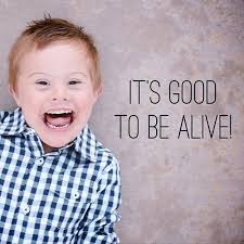 Can A Person With Down Syndrome Have A Quality Life Down Syndrome Kids Down Syndrome Down Syndrome Baby
