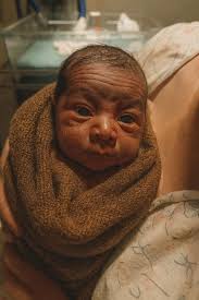 daughter faces prejudice due to appearance