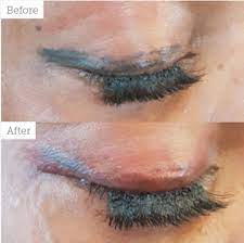 The heavily pigmented formula covers the darkest tattoos then dries to a matte finish. Permanent Makeup Removal Aesthetics