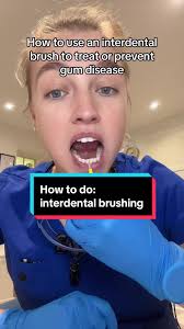 How to Use an Interdental Brush for Gum Disease Prevention