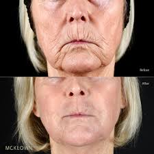 Could you kind people possibly fix my mouth I was in mid tear up when this  was taken. Also the lighter bit