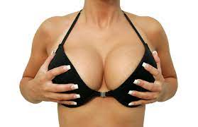 XL Breast Augmentation in Miami, FL | Extra Large Breast Implants