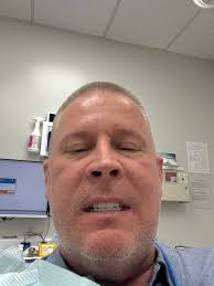 What shade of color teeth can you choose