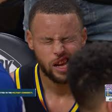 Stephen Curry was bleeding after accidentally getting hit in the face by  Buddy Hield.