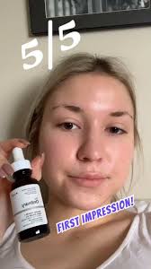 I was actually blown away at how well. The Ordinary Ascorbic Acid 8 Alpha Arbutin 2 Reviews Supergreat