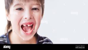 Tooth copy hi-res stock photography and images