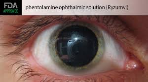 Image result for Mydriatic