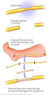 Resultado de imagen de nervios